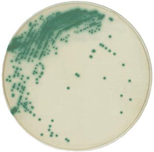 日水金黄色葡萄球菌显色培养基X-SA