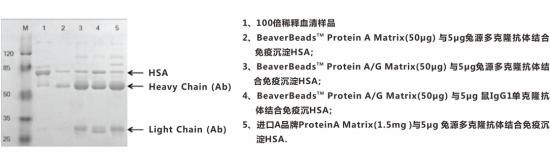 免疫沉淀磁珠