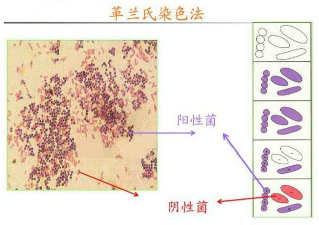 革兰氏染液染色的步骤分析