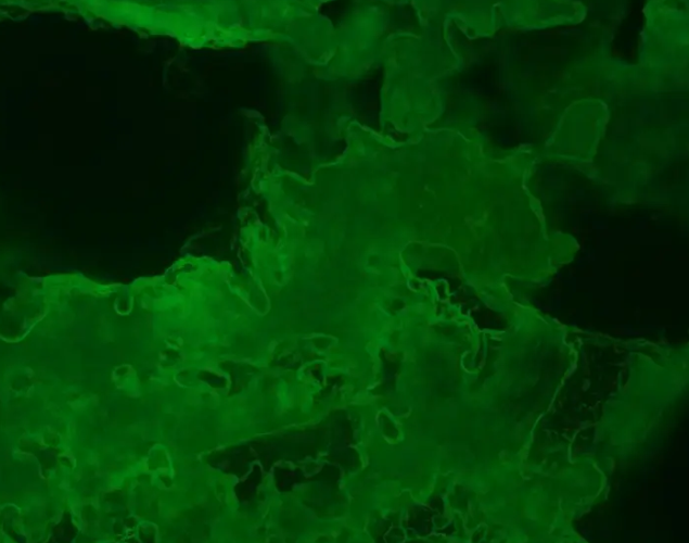 FITC-Chitoshai  MW：20K绿色荧光标记壳聚糖的应用