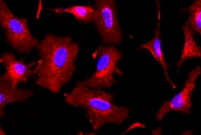 菜豆白细胞凝集素(PHA-L)，Unconjugated Phaseolus Vulgaris Leucoagglutinin (PHA-L)