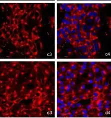 Biotin-GSL I B4;生物素化单叶灰树凝集素I(GSL I)分离蛋白B4，Biotinylated Griffonia Simplicifolia Lectin I (GSL I) isolectin B4