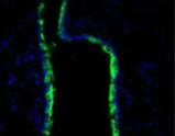 Agarose bound-DSL;琼脂糖结合曼陀罗凝集素(DSL)，Agarose bound Datura Stramonium Lectin (DSL)