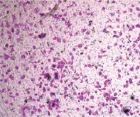 Biotin-LEL,TL;生物素化番茄凝集素(LEL,TL)，Biotinylated Lycopersicon Esculentum (Tomato) Lectin (LEL, TL)