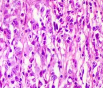 FITC-WFA,WFL;荧光素标记紫藤凝集素(WFA,WFL)，Fluorescein labeled Wisteria Floribunda Lectin (WFA, WFL)