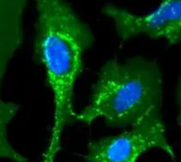 Agarose bound-WGA;琼脂糖结合小麦胚芽凝集素(WGA)，Agarose bound Wheat Germ Agglutinin (WGA)