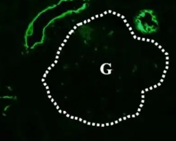 FITC-UEA I;荧光素标记的荆豆凝集素(UEA-I)，Fluorescein labeled Ulex Europaeus Agglutinin I (UEA I)