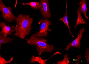 FITC-SNA,EBL;荧光素标记的黑接骨木凝集素(SNA,EBL)，Fluorescein labeled Sambucus Nigra Lectin (SNA, EBL)