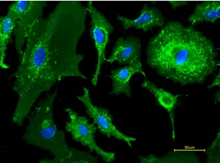 FITC-LCA荧光素标记小扁豆凝集素(LCA)，Fluorescein labeled Lens Culinaris Agglutinin (LCA)