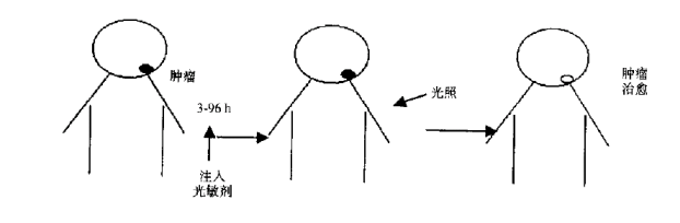 1602469587777286.png 酞菁类光敏剂的特点和光动力治疗原理简介