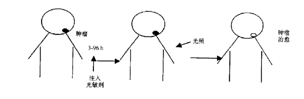 酞菁类光敏剂的特点和光动力治疗原理简介