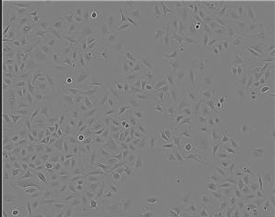 NCI-H292肺癌细胞膜复合纳米脂质体|肿瘤细胞膜杂化脂质体载紫杉醇使用方法