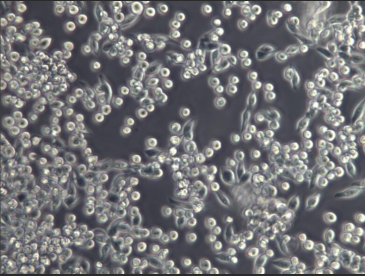 MKN-45胃癌细胞膜修饰纳米囊泡|供应载阿霉素细胞膜纳米囊泡